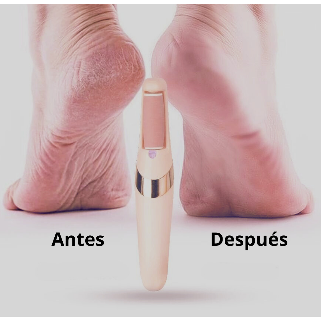 REMOVEDOR QUITA CALLOS RECARGABLE